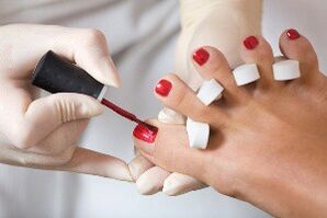 Des modes d'infection et des causes de l'apparence du champignon sur les ongles des jambes